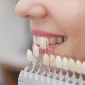 dental force sensors for prosthodontics.jpg
